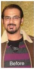 Ahmed Hassan before treatment