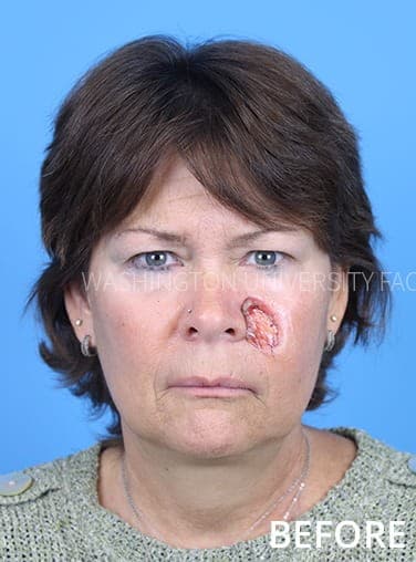 Isabella Martinez before treatment
